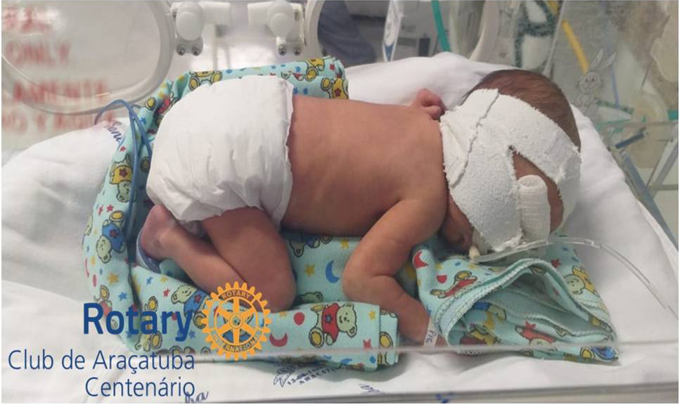 Doação de coeiros para a UTI neonatal da Santa Casa